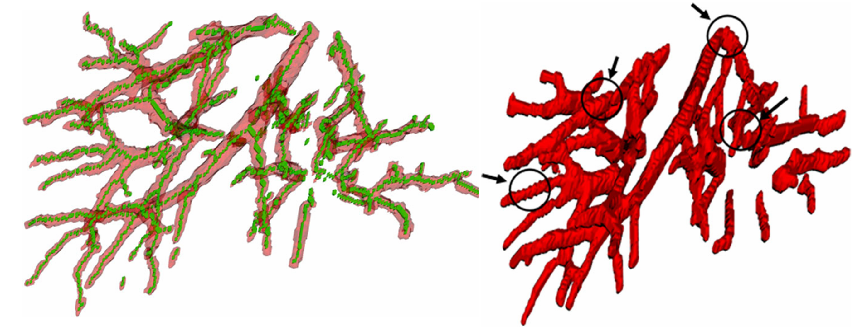 A novel method to model hepatic vascular network using vessel segmentation, skeleton extraction and topology optimization